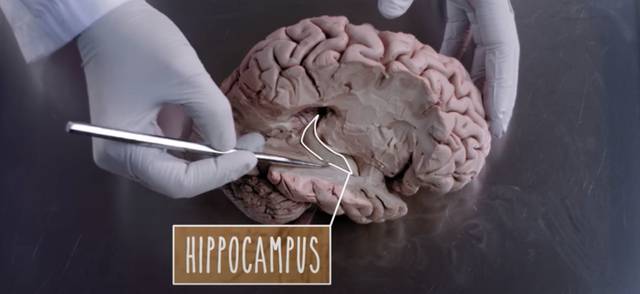 UBC's Dr. Claudia Krebs shows where the hippocampus is on a cross section of a human brain in a neuroanatomy video.