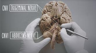 Dr. Claudia Krebs shows the human brain in a UBC neuroanatomy video